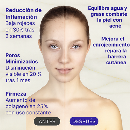 Máscara facial LED con terapia de luz roja - OptiDerma™